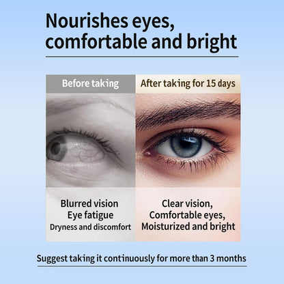 Eye Health Supplement with Antioxidants 120 Softgels