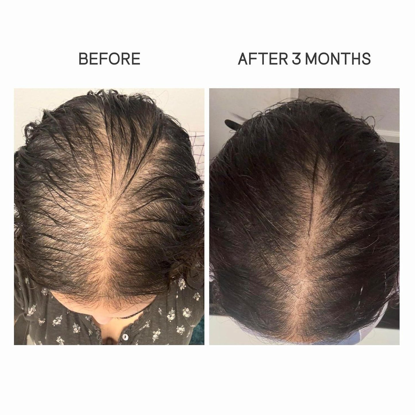 Natural Hair Growth Oil for Postpartum Regrowth 60ml