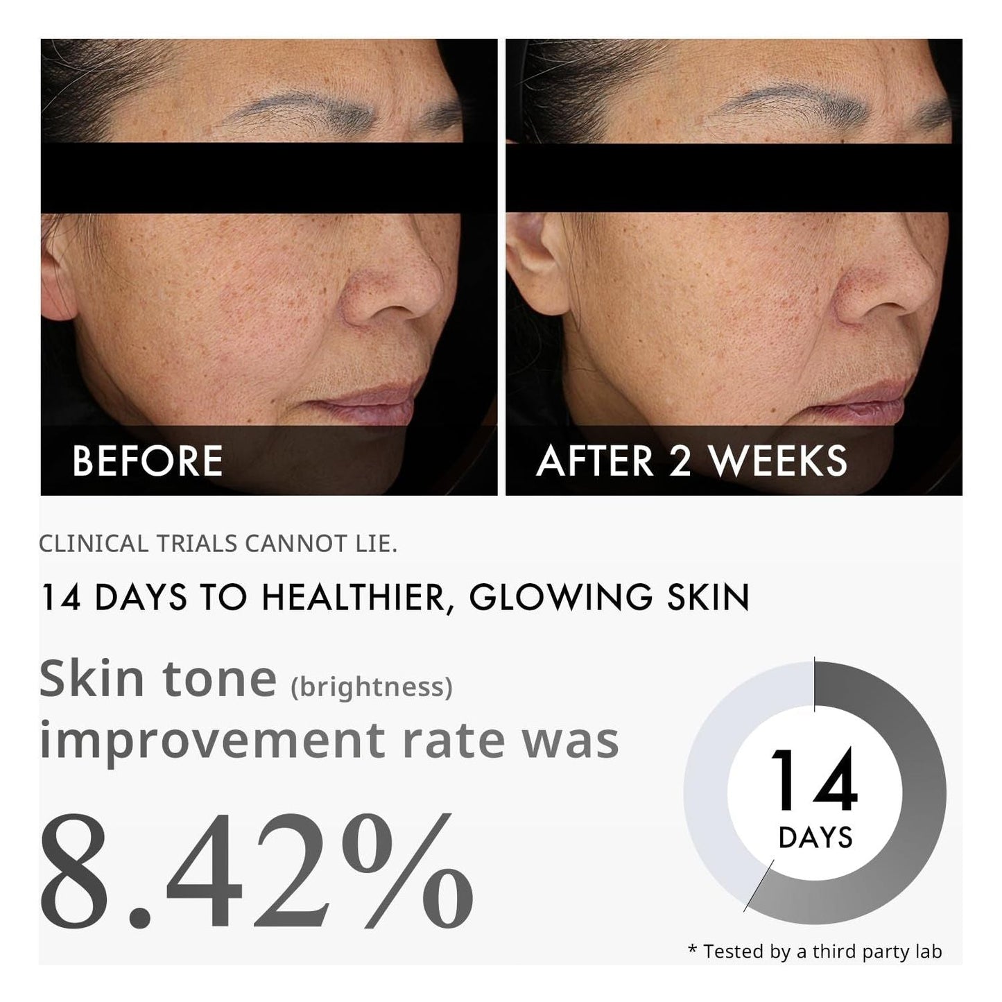 Brightening Dark Spot Serum with Niacinamide 30ml