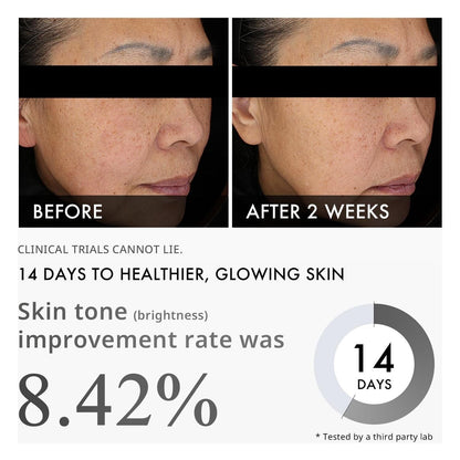 Brightening Dark Spot Serum with Niacinamide 30ml