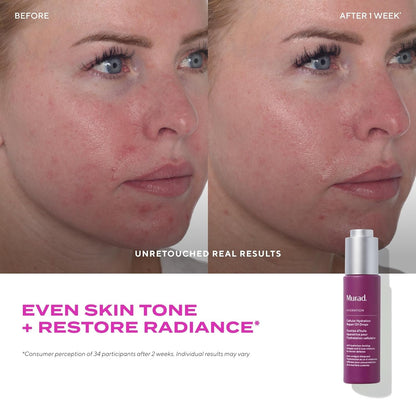 Nourishing Facial Oil Drops 30ml | Quick Absorb Moisturizer
