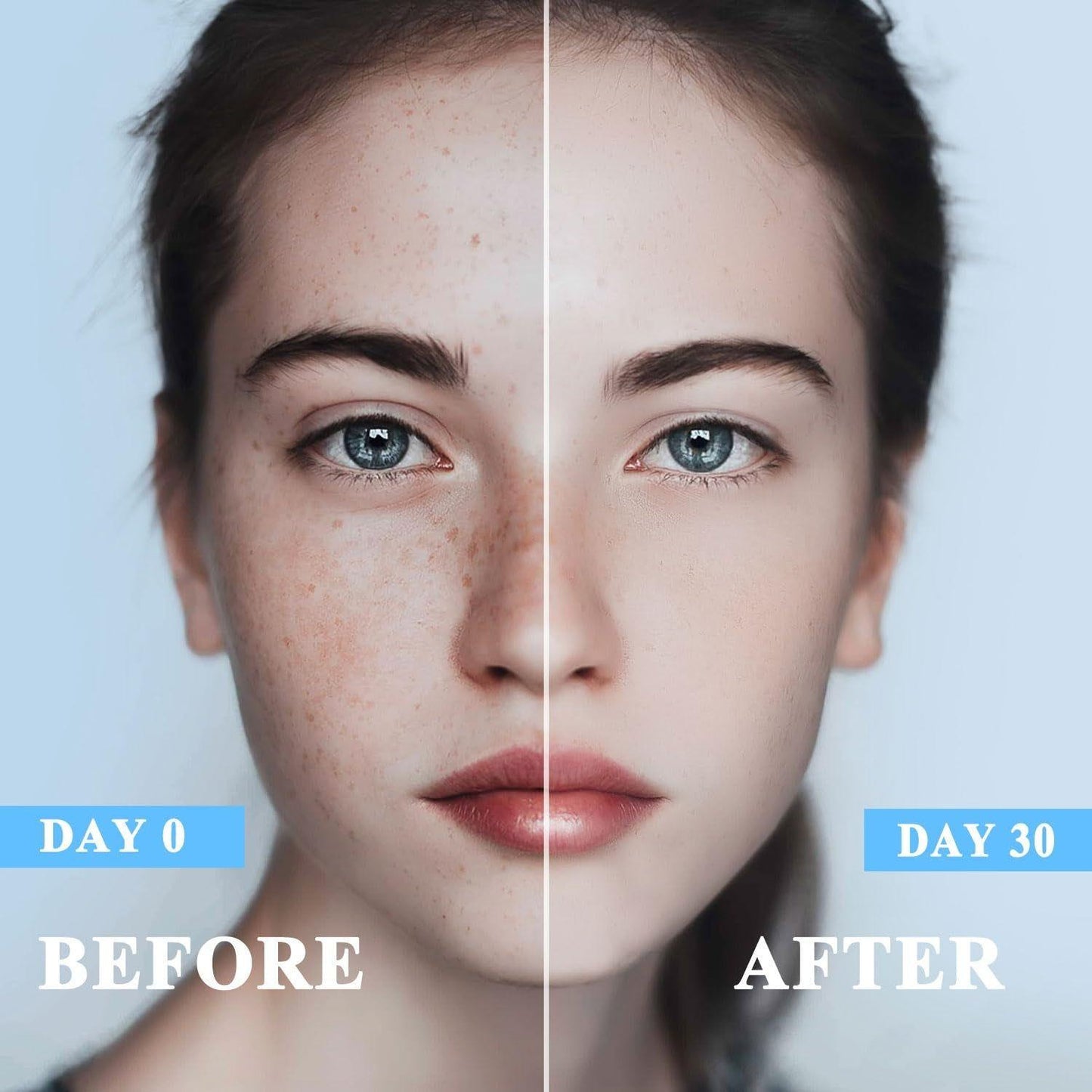 Intensive Dark Spot Remover Serum - 50ml