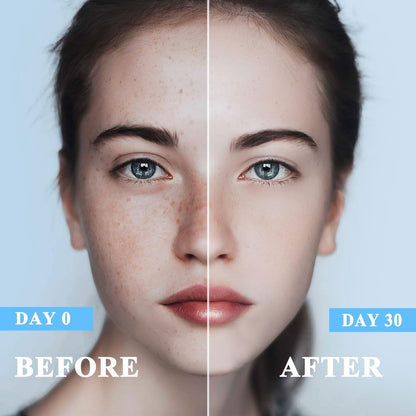 Intensive Dark Spot Remover Serum - 50ml