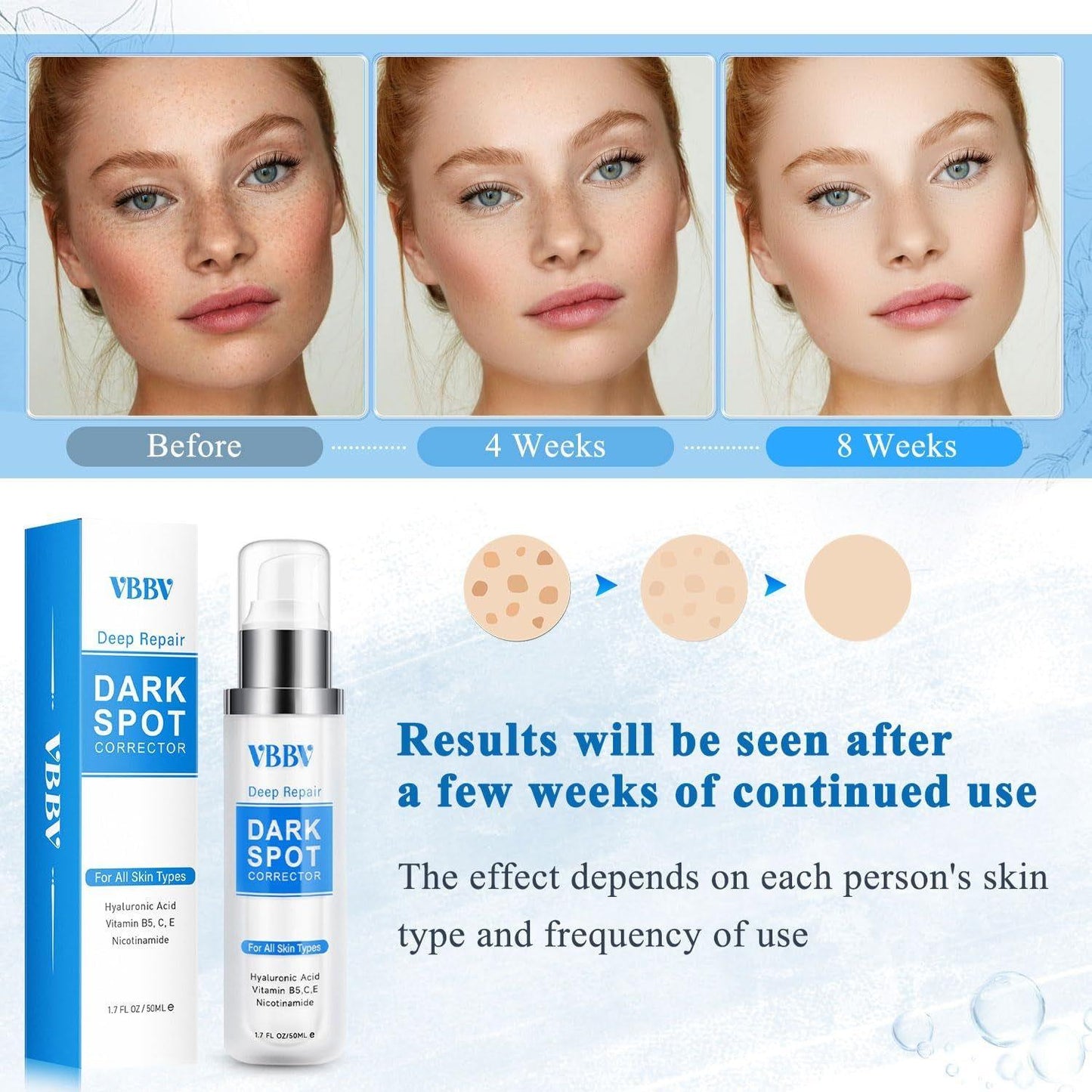 Intensive Dark Spot Remover Serum - 50ml