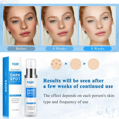 Intensive Dark Spot Remover Serum - 50ml