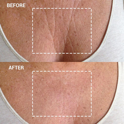 Anti Aging Chest Smoothing Silicone Patch