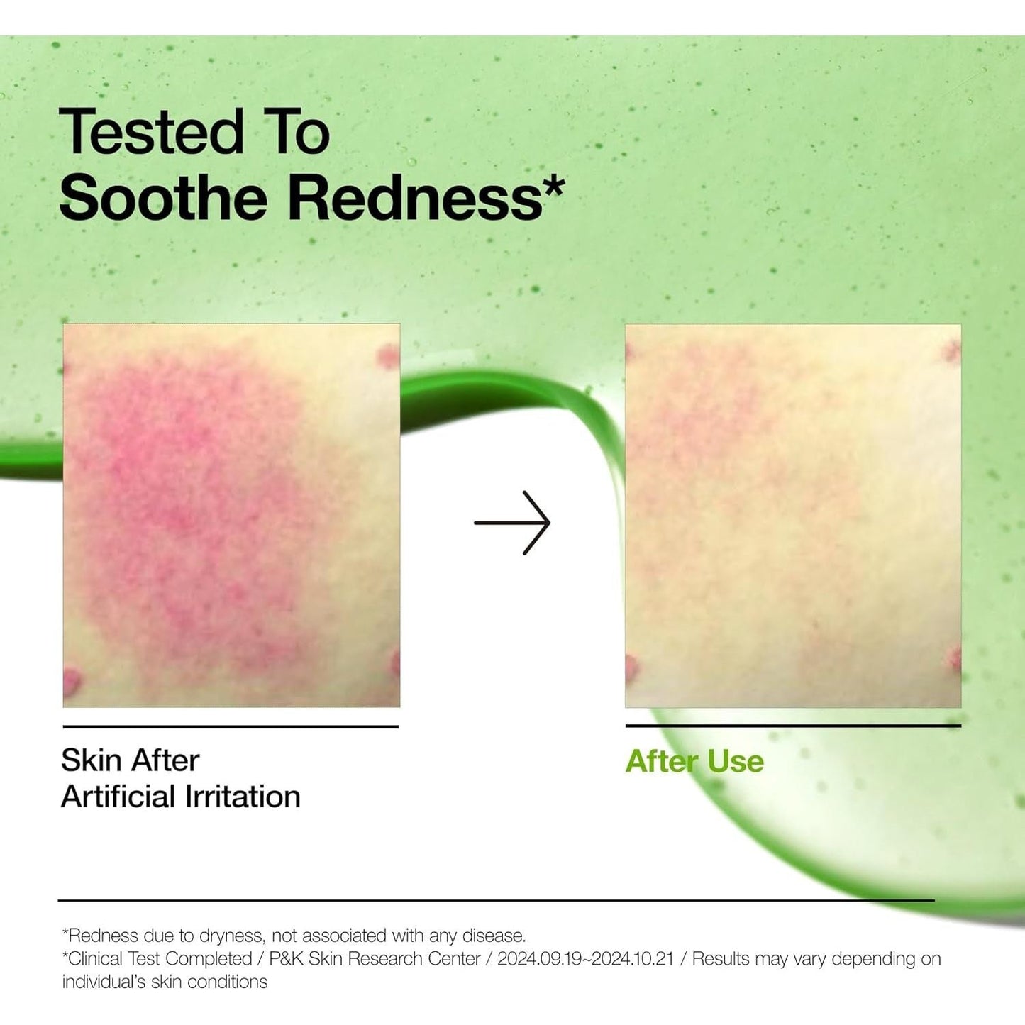 Gentle Azelaic Acid Calming Face Serum For Sensitive Skin
