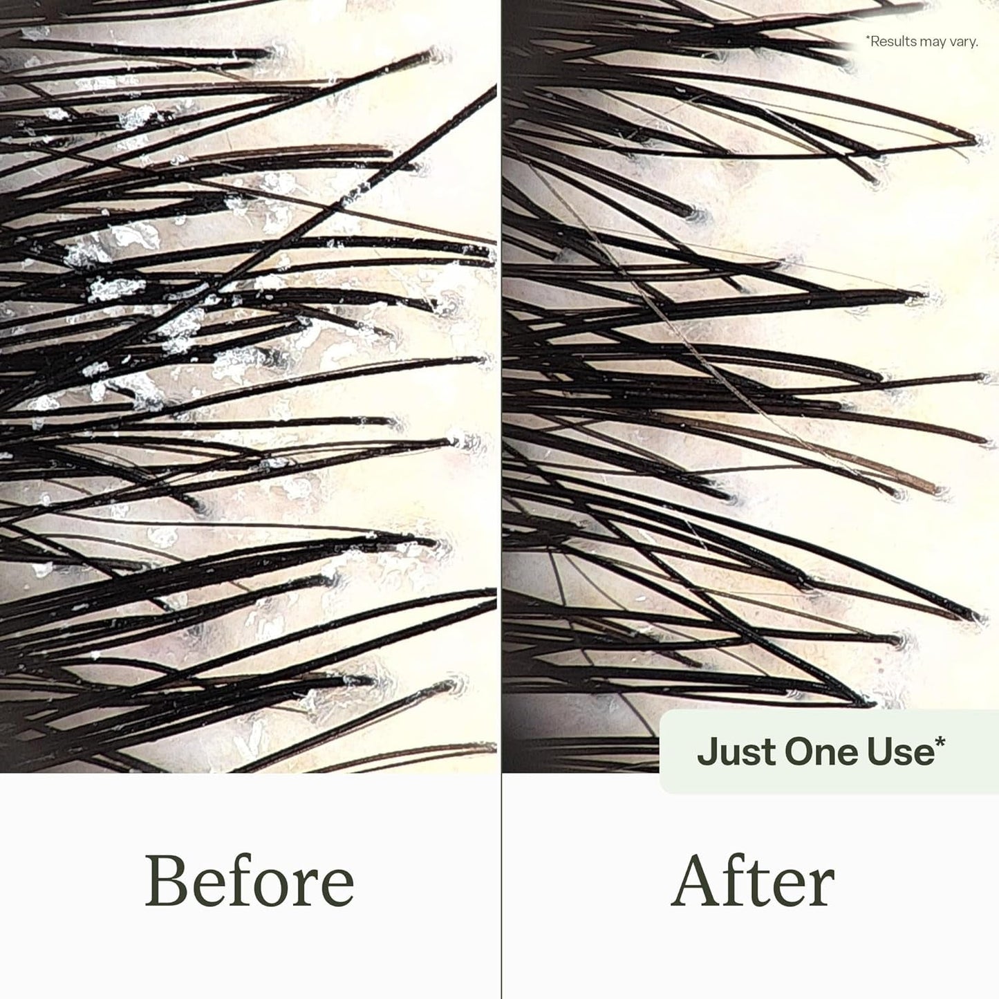 Purifying Scalp Refresh Shampoo - Gentle Buildup Remover