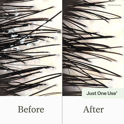Purifying Scalp Refresh Shampoo - Gentle Buildup Remover