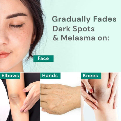 Intensive Dark Spot Facial Cream for Brighter Skin