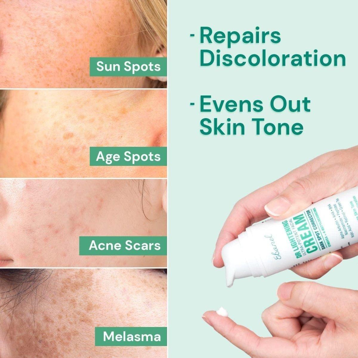 Intensive Dark Spot Facial Cream for Brighter Skin