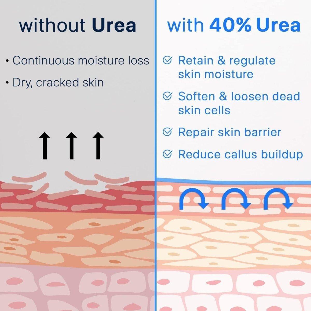 Intensive Foot Moisturizer Cream 40% Urea