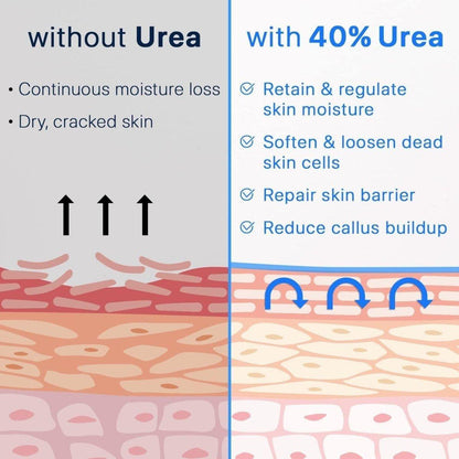 Intensive Foot Moisturizer Cream 40% Urea