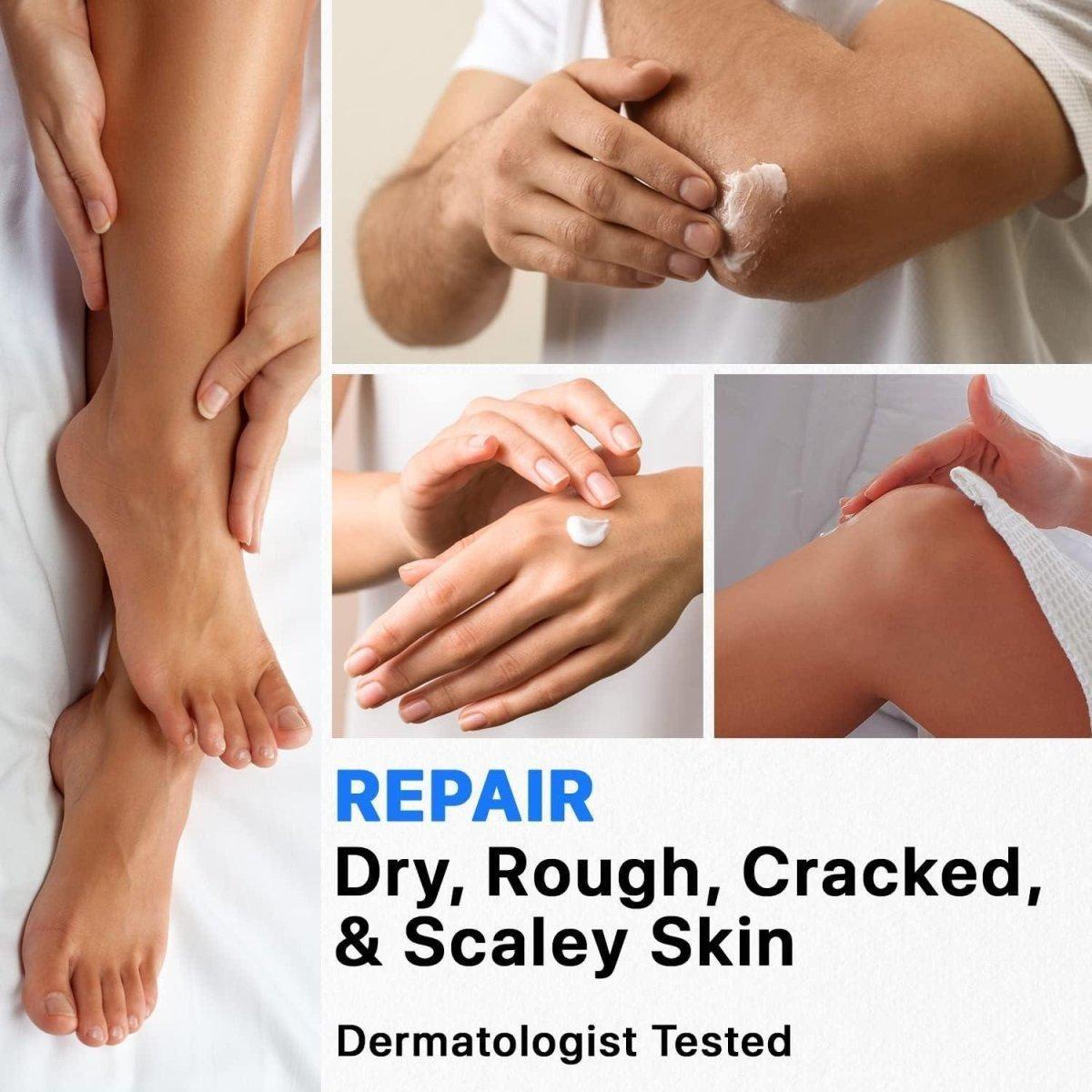Intensive Foot Moisturizer Cream 40% Urea
