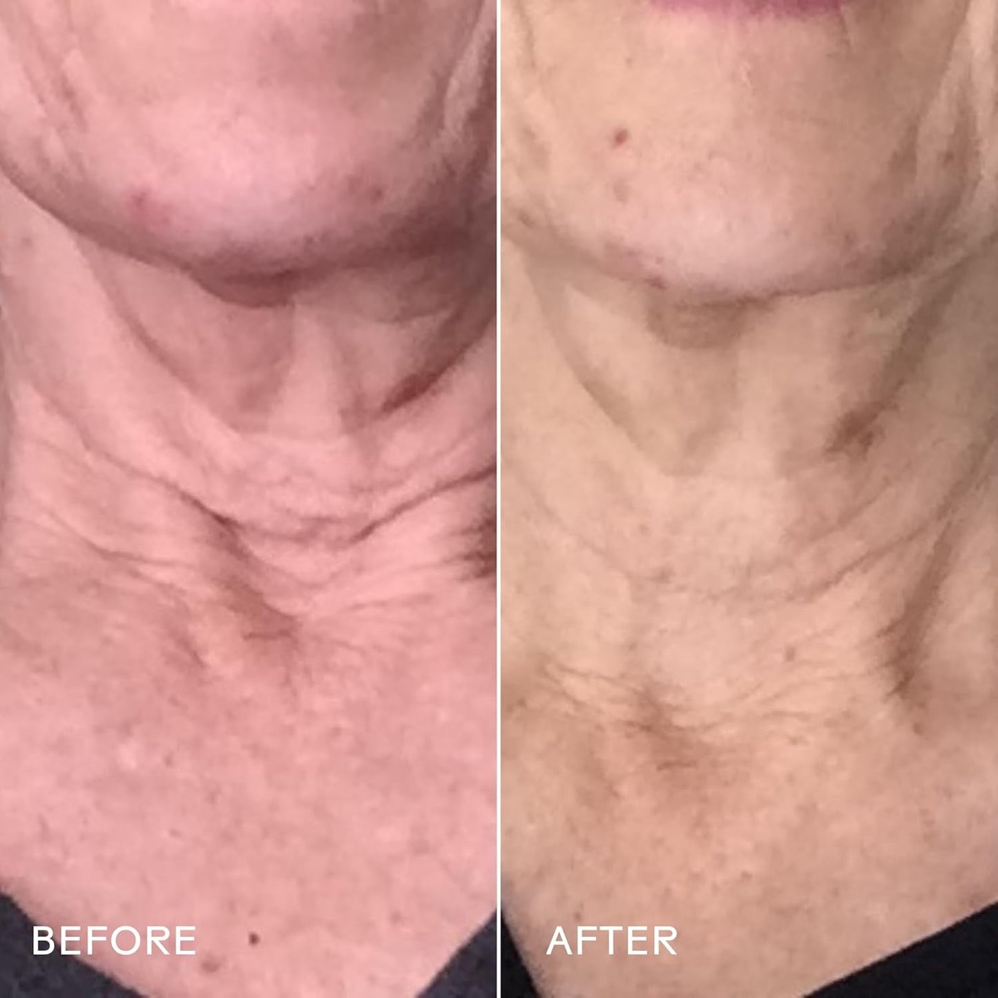 Rich Hydrating Stem Cell Neck Moisturizer Cream