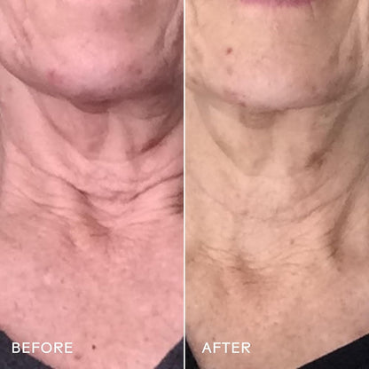 Rich Hydrating Stem Cell Neck Moisturizer Cream