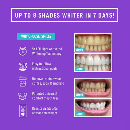 Advanced At-Home Teeth Whitening Kit with LED Light