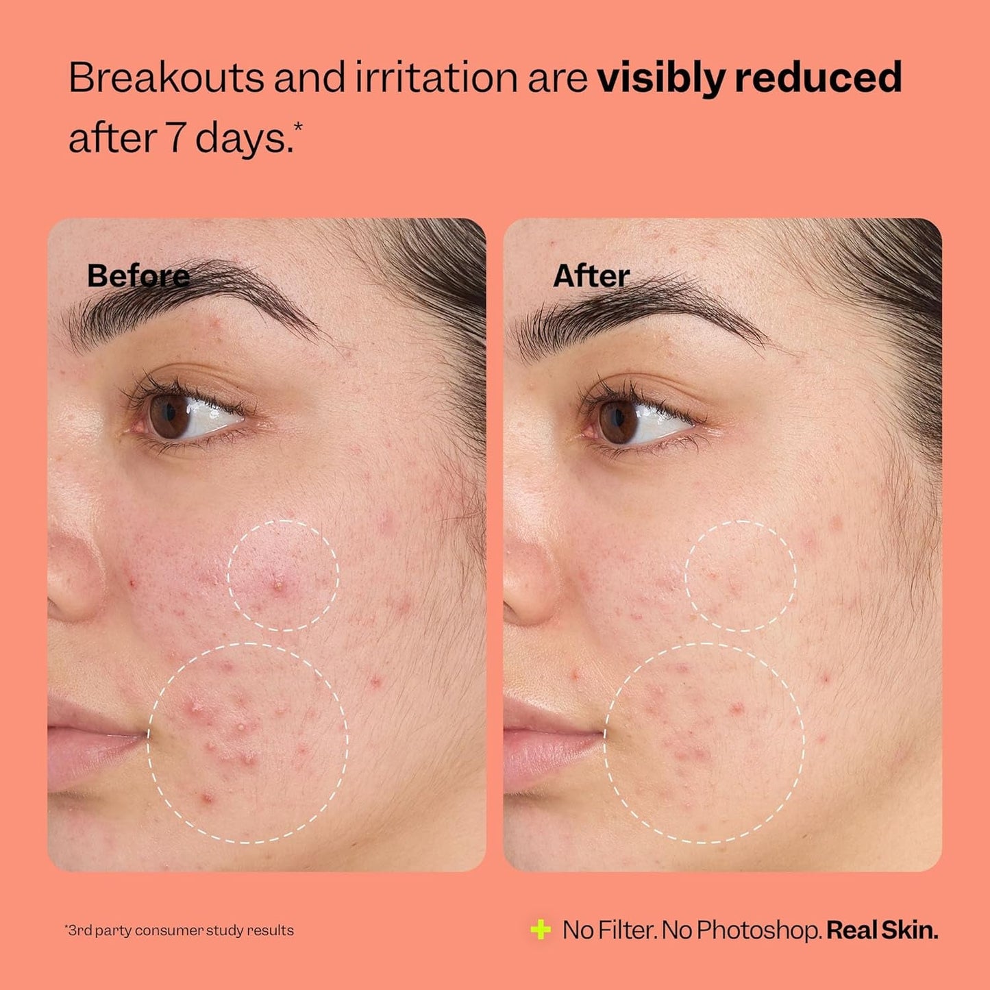 Soothing Skin Recovery Mist 120ml Calms Soothes Face