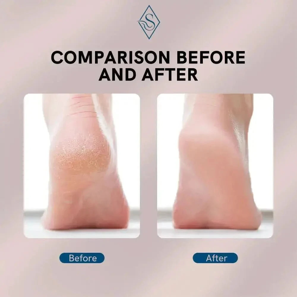 Rechargeable Heel Smoother Foot Grinder