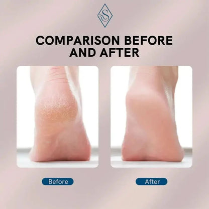 Rechargeable Heel Smoother Foot Grinder