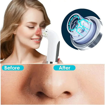 Portable Pore Cleansing Facial Tool