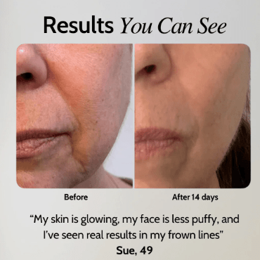 At-Home Facial Toning Device Kit