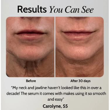 At-Home Facial Toning Device Kit