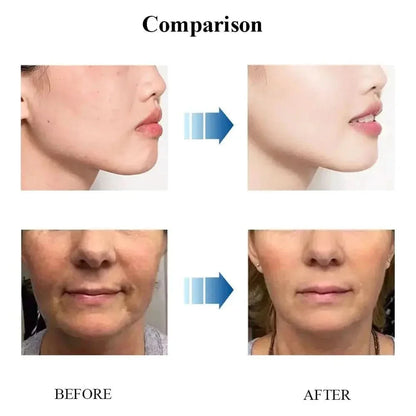 Natural Anti Wrinkle Face Moisturizer Cream