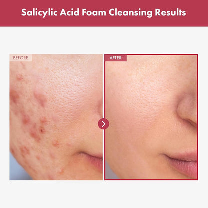 Gentle Exfoliating Face Wash 100ml - Pure Skin Cleanser