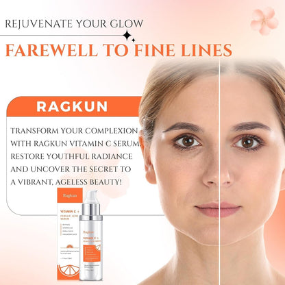 Natural Vitamin C Face Serum 20% - Anti Aging Moisturizer
