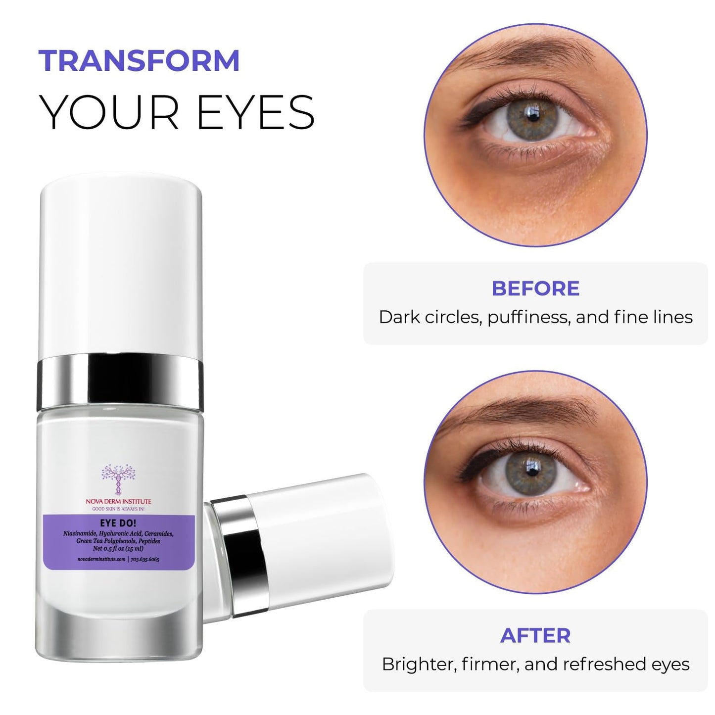 Anti Aging Eye Cream Reduces Dark Circles