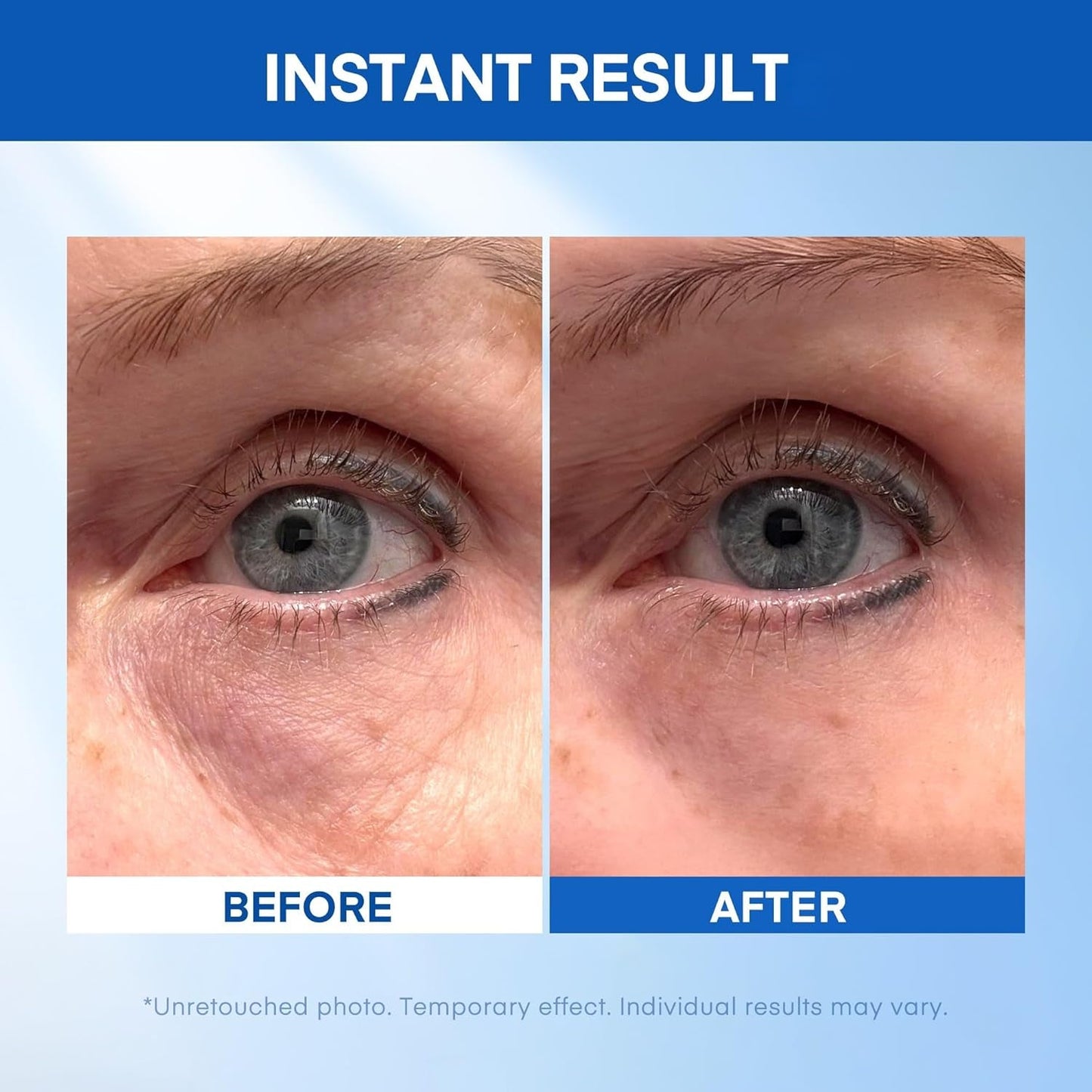 Anti Aging Eye Serum with Lifting Technology 20ml