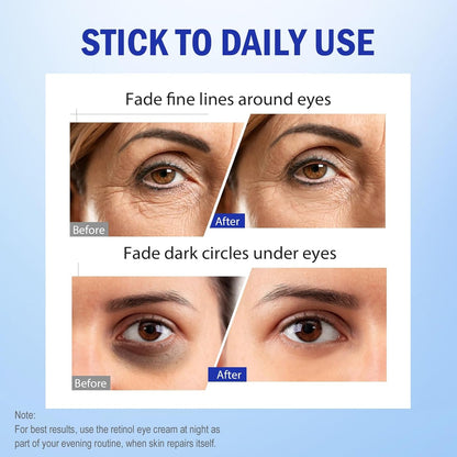 Anti Aging Eye Cream for Dark Circles & Fine Lines