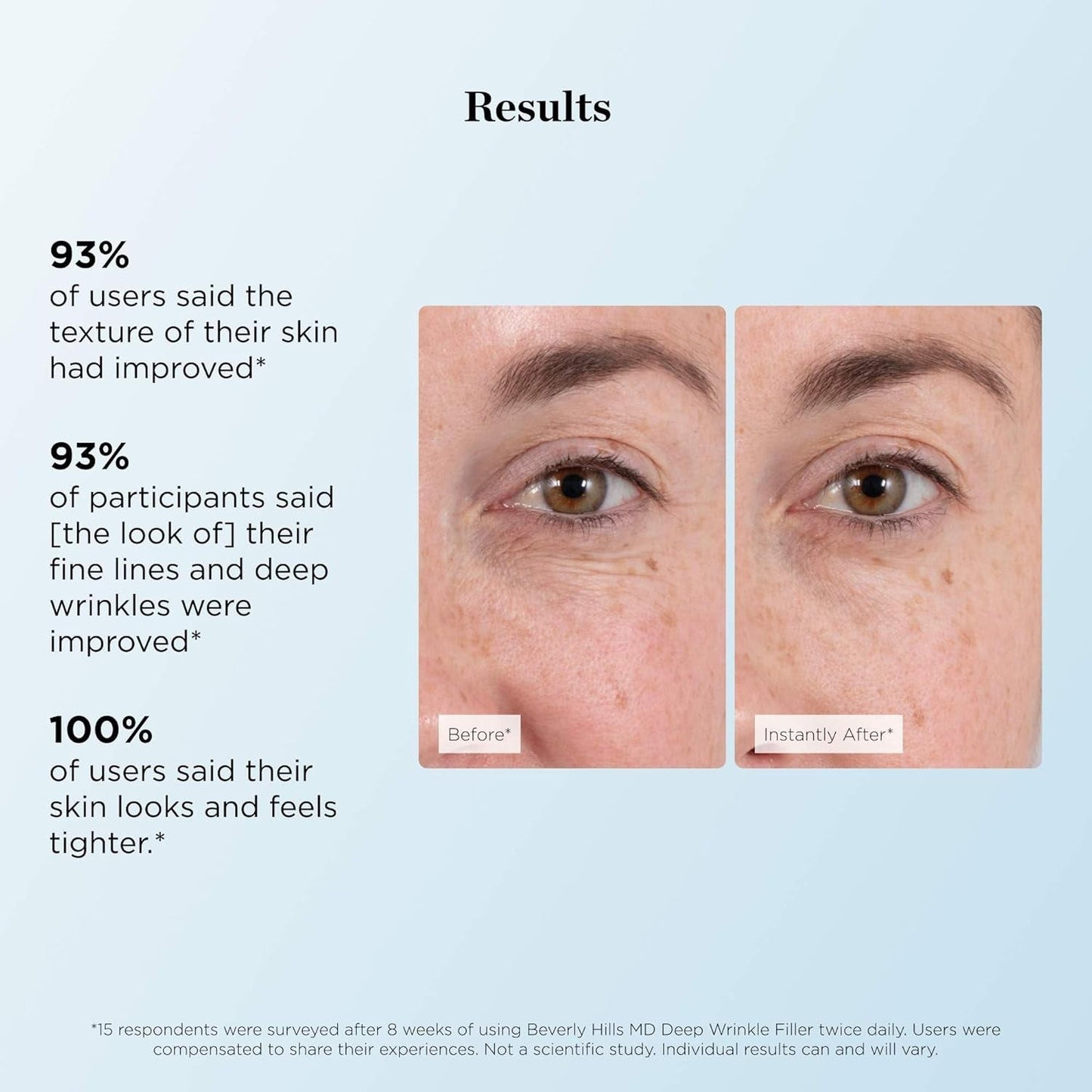 Anti Aging Wrinkle Cream for Fine Lines & Deep Wrinkles
