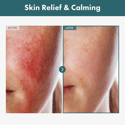 Soothing Cica Face Cream 100ml - Calming Redness Relief Moisturizer