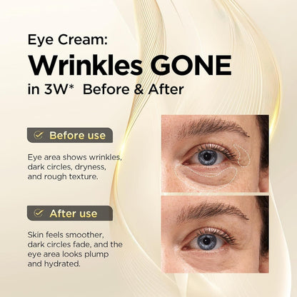 Anti Aging Eye Cream 30ml - Fades Dark Circles Wrinkles