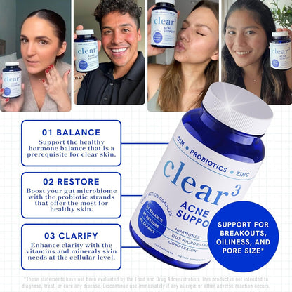Natural Acne Relief Supplement - 120 Capsules