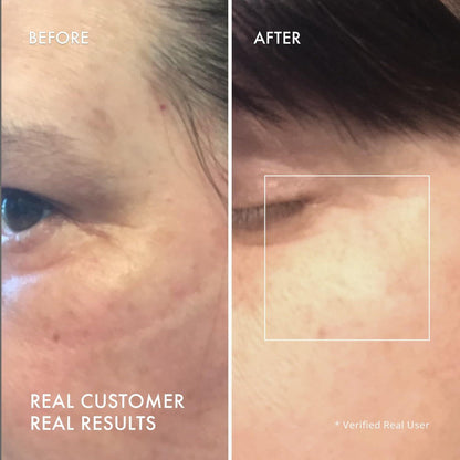 Brightening Anti-Puff Eye Masks with Caffeine & Niacinamide