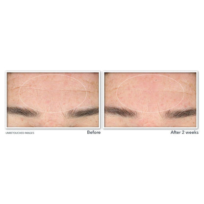 Anti Aging Retinol Face Serum Cleanser 177ml