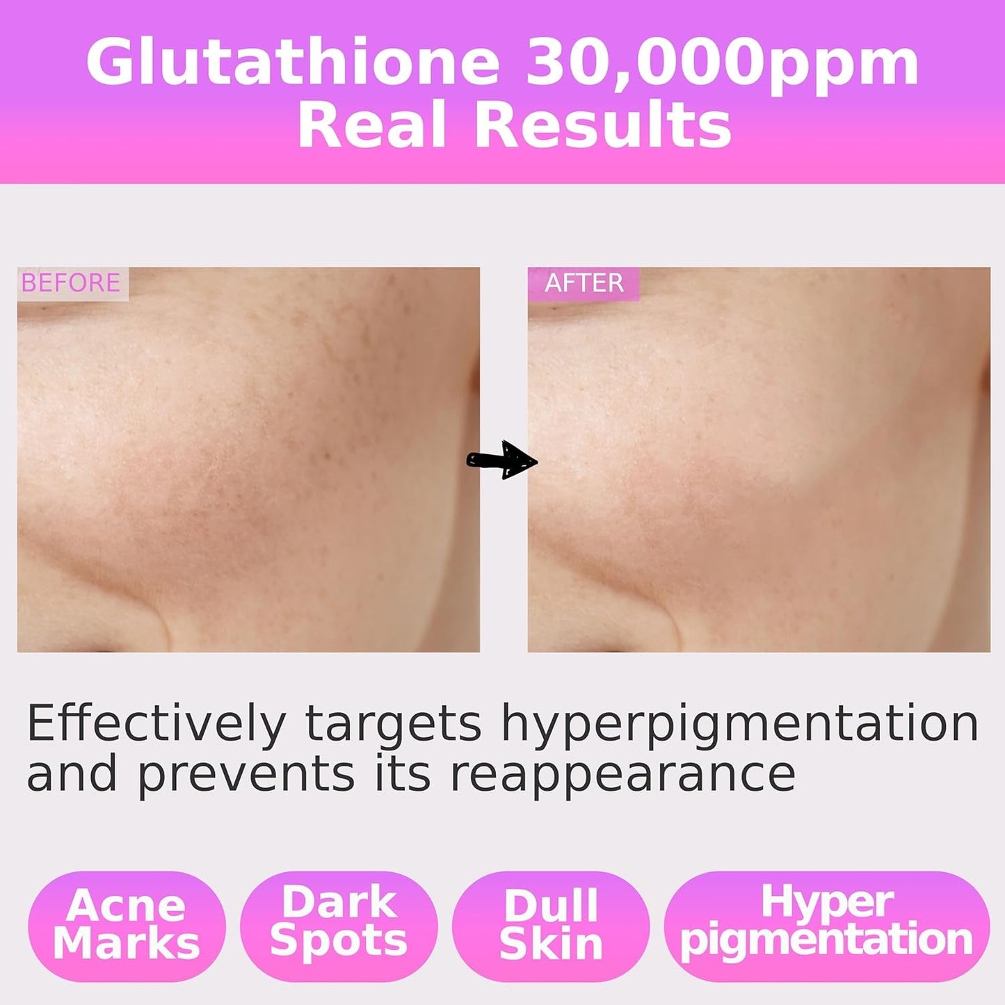 Intensely Brightening Glutathione Face Serum 30ml