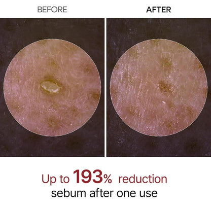 Natural Exfoliating Face Serum with Niacinamide & Rice Extract
