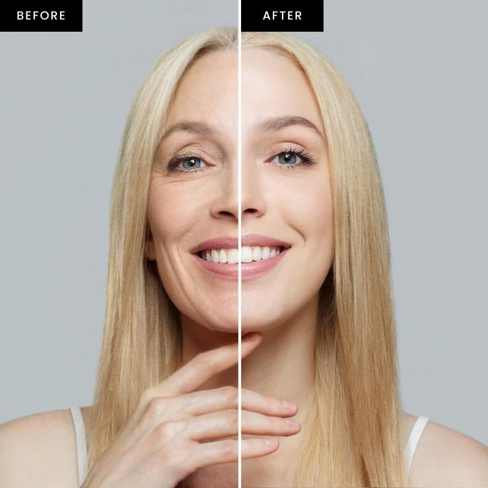 Natural Face Skin Toner & Dark Spot Remover