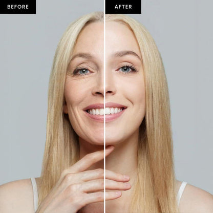 Natural Face Skin Toner & Dark Spot Remover