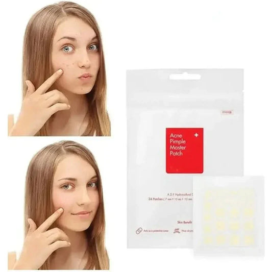 Acne Spot Blemish Care Repair Stickers - Mycosmeticslondon