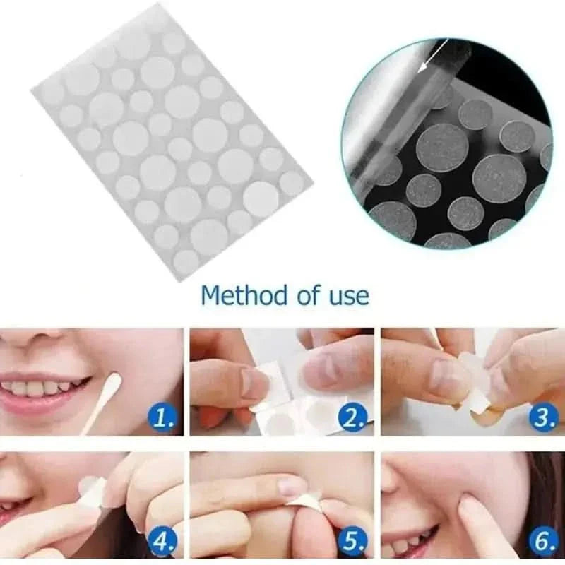 Acne Spot Blemish Care Repair Stickers