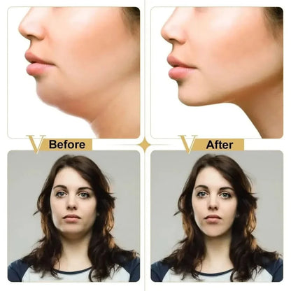Contouring Face Mask for Slimmer Jawline & Defined Face