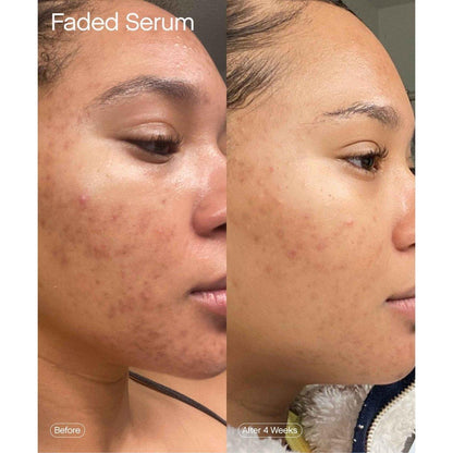 Brightening Dark Spot Corrector Serum 50ml