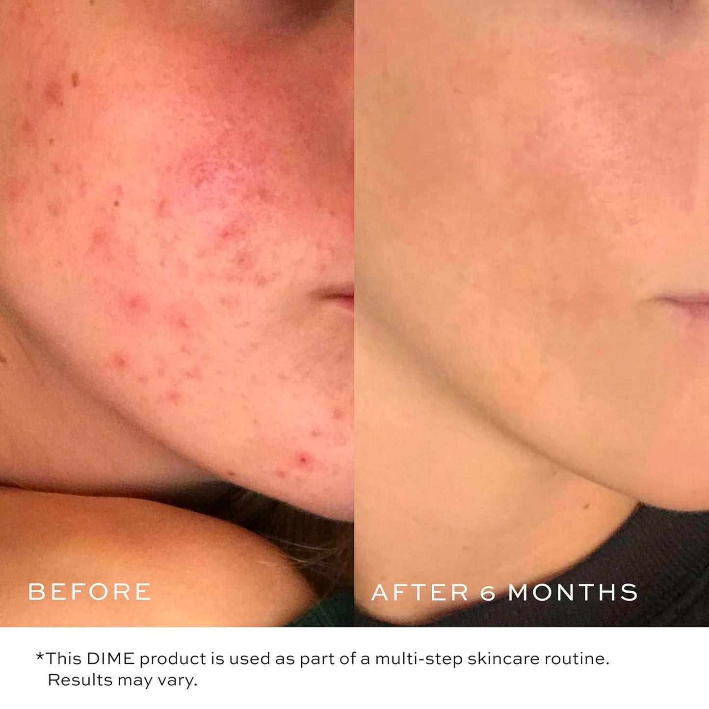 Soothing Gel Face Wash - 120ml | Moisturizing Cleanser