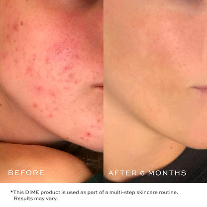 Soothing Gel Face Wash - 120ml | Moisturizing Cleanser