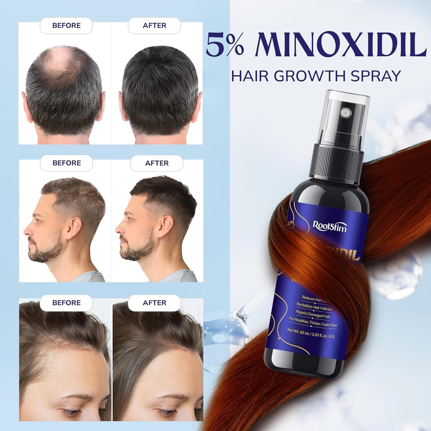 Strong Hair Regrowth Serum for Men and Women